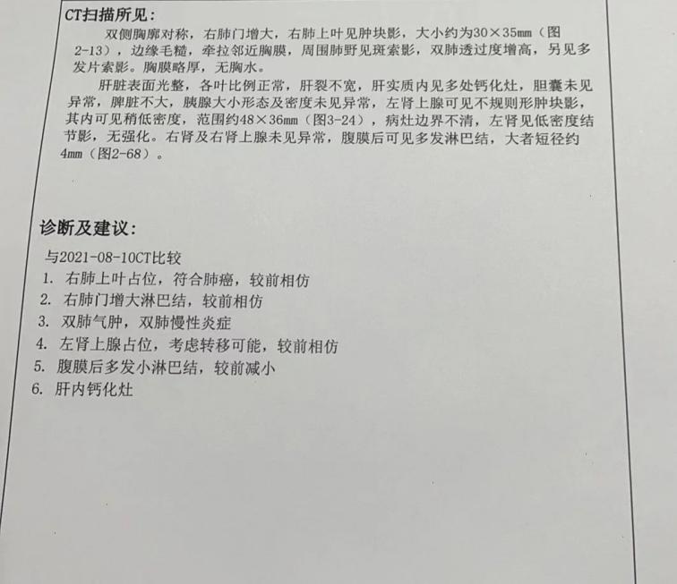 贝达药业：盐酸恩沙替尼胶囊在美国开出首张处方单