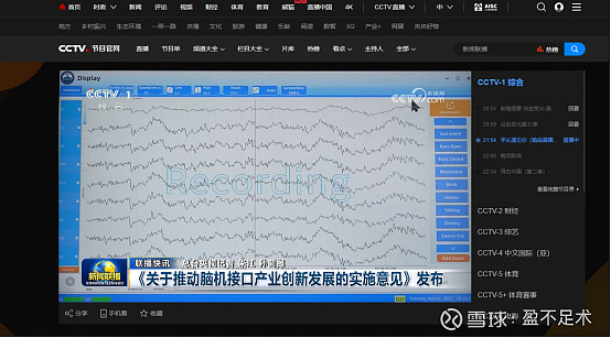 爱朋医疗携手中国科学院深圳先进院成立“脑机接口”创新联合体