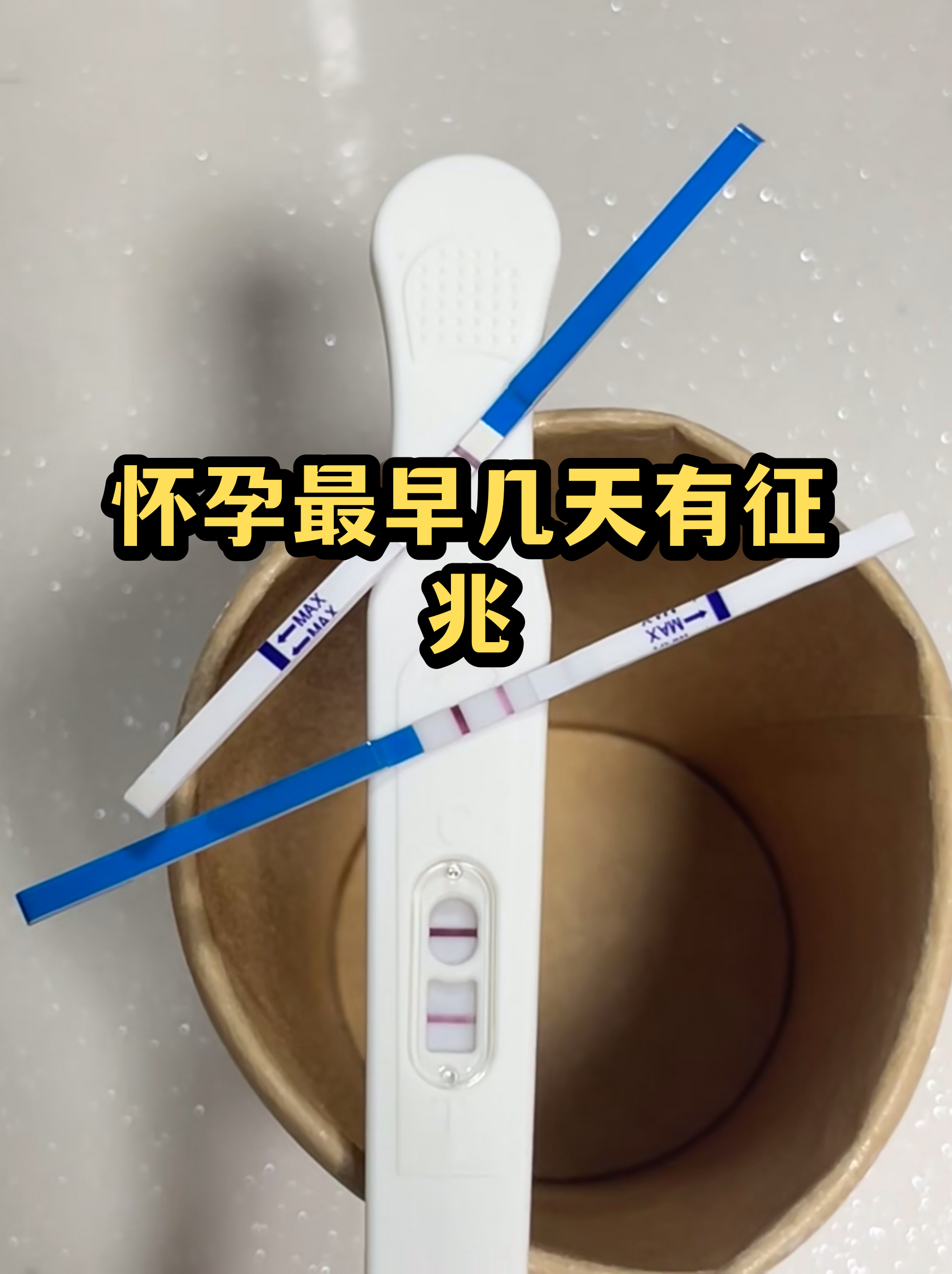 身体出现这些迹象,说明你已经累过头了